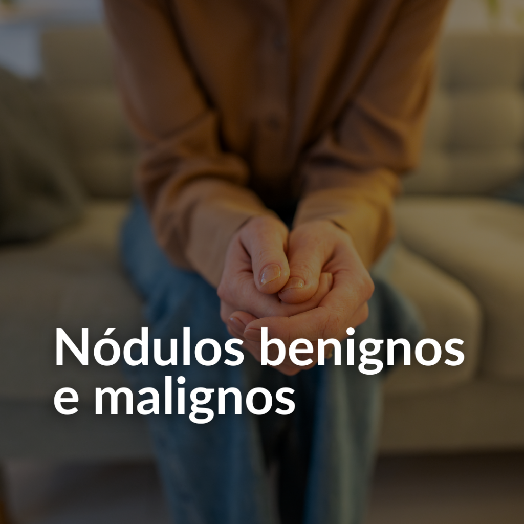 Nódulos benignos e malignos