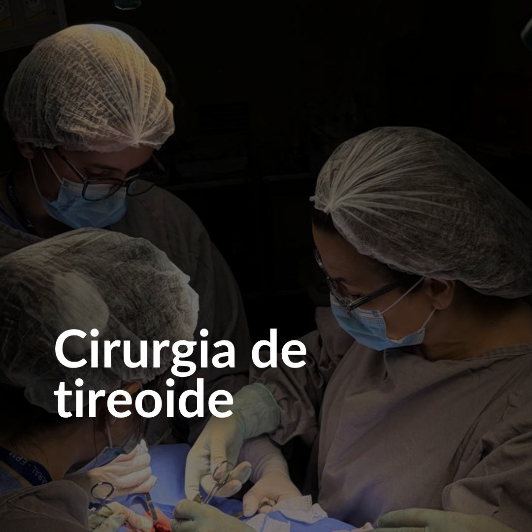 Cirurgia de tireoide