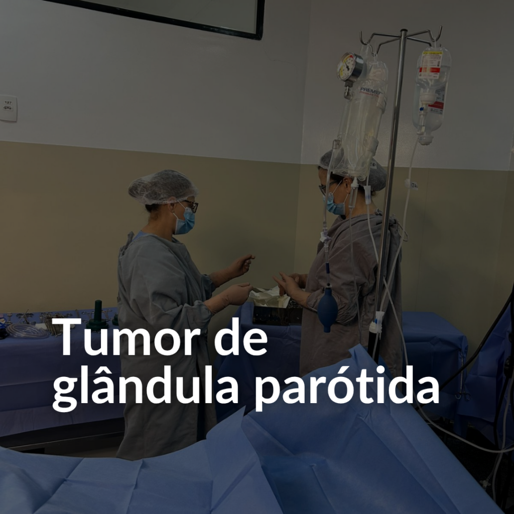 Tumor de glândula parótida