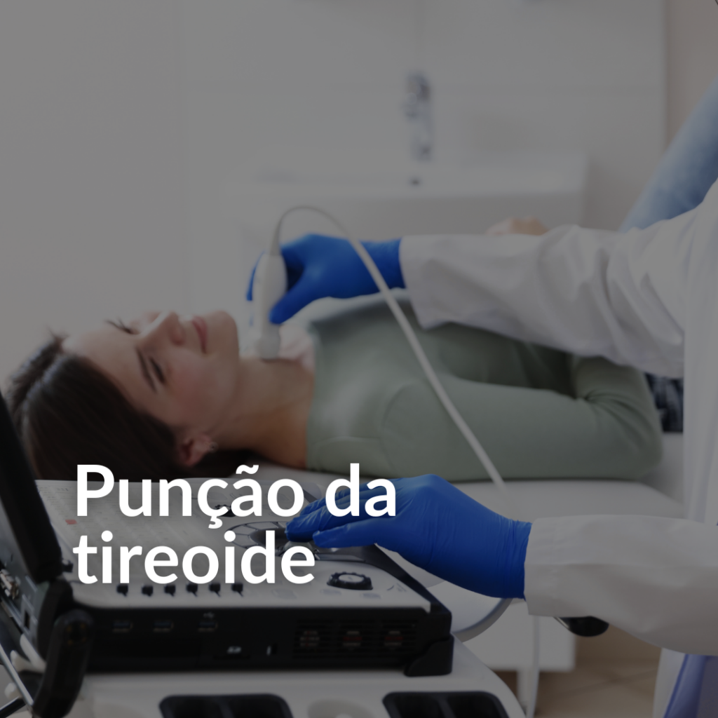 punção de nódulo no pescoço