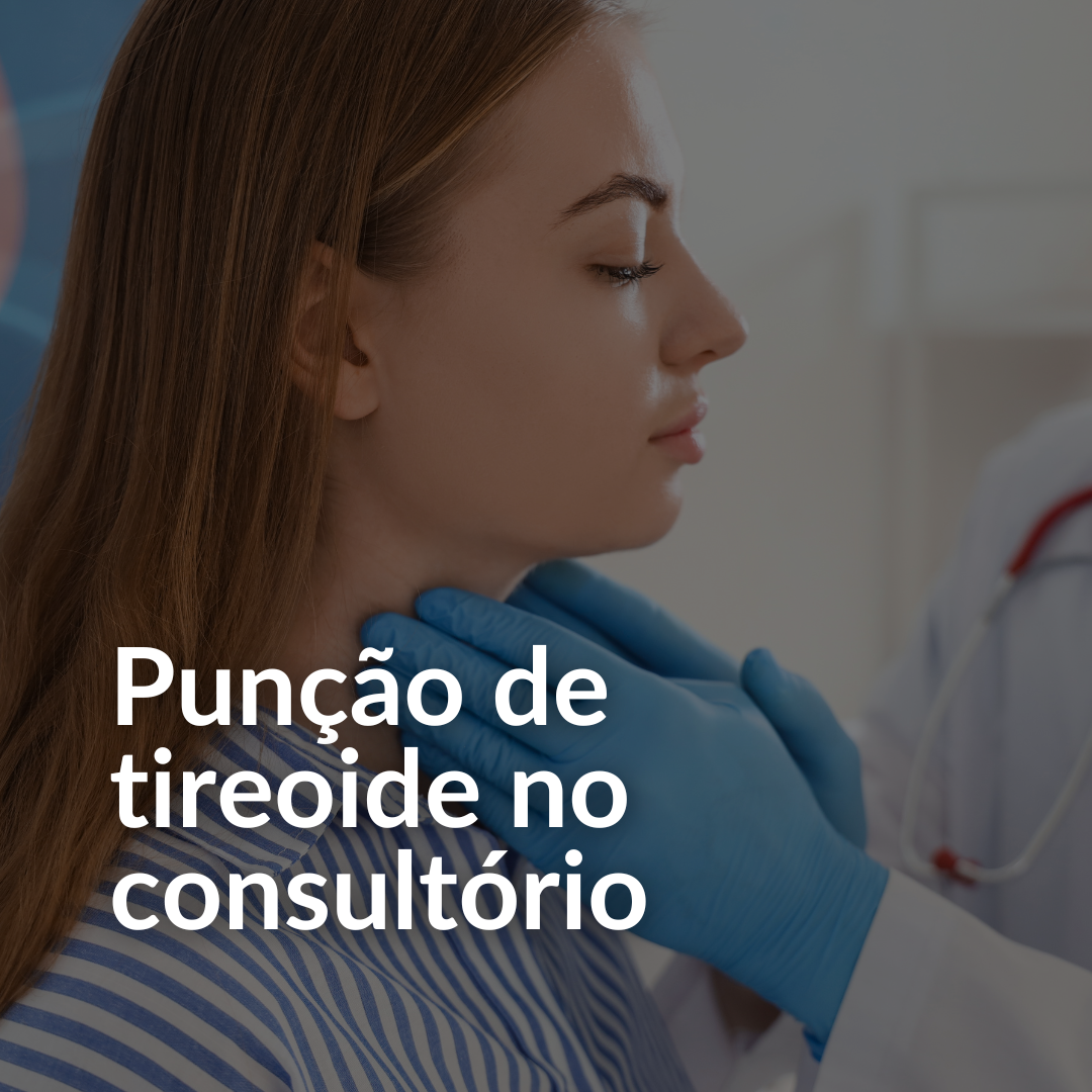 punção de tireoide no consultório