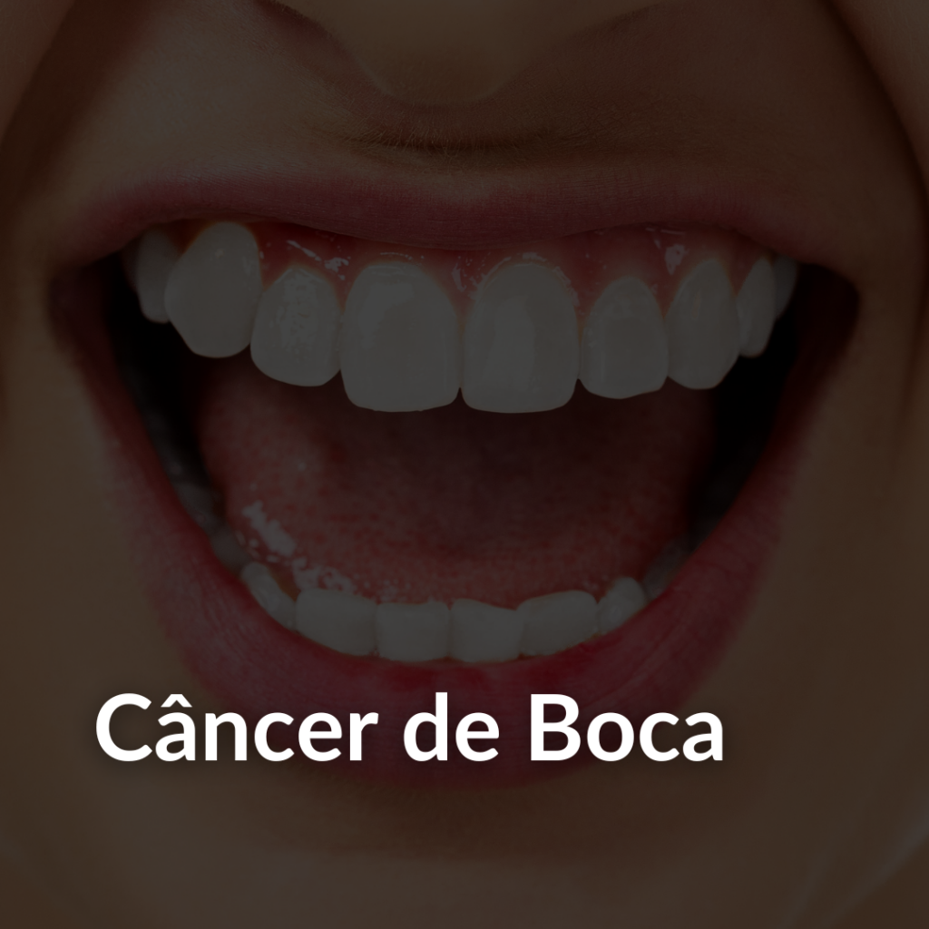 biópsia lesão na boca
