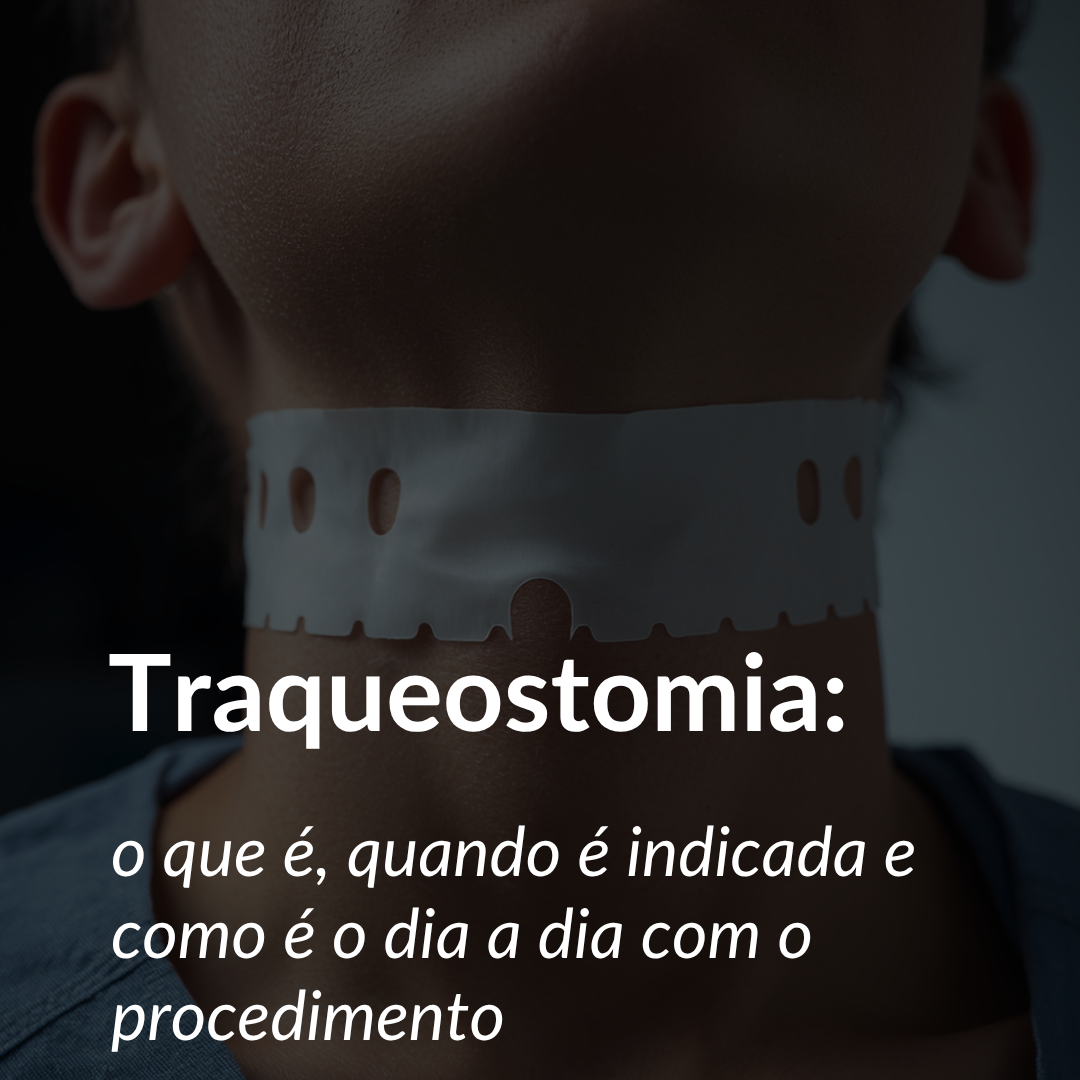 cisto branquial