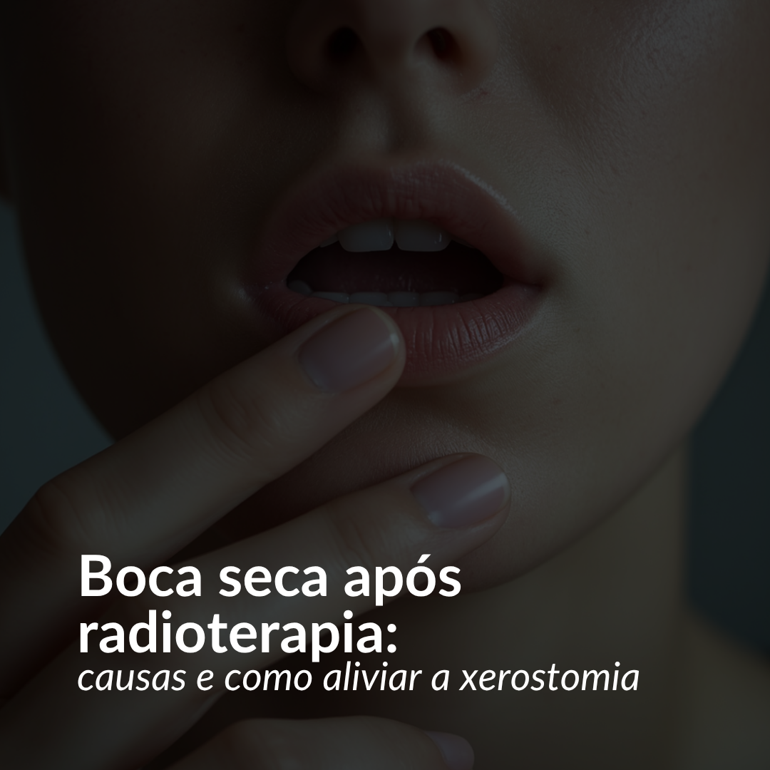 Boca seca após radioterapia: causas e como aliviar a xerostomia