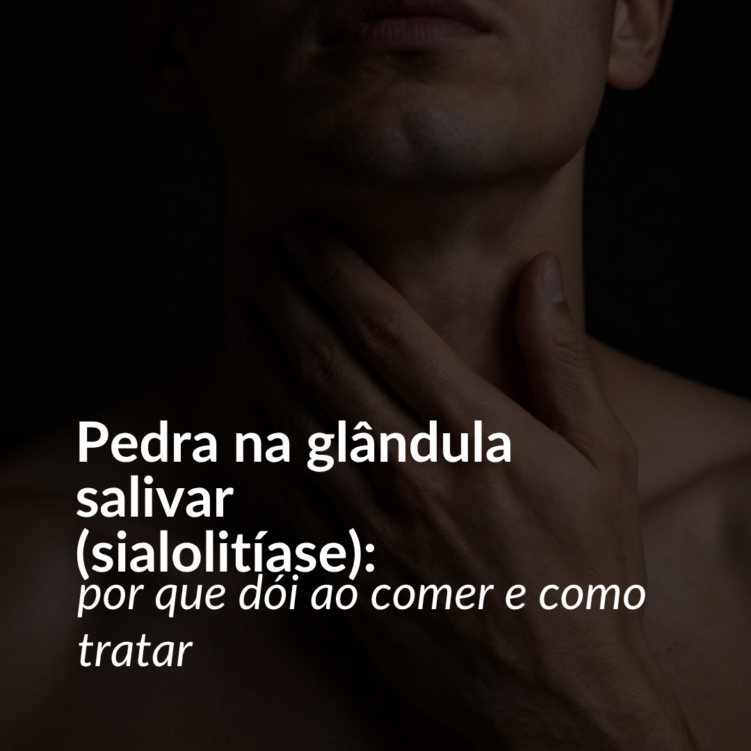 Pedra na glândula salivar (sialolitíase): por que dói ao comer e como tratar