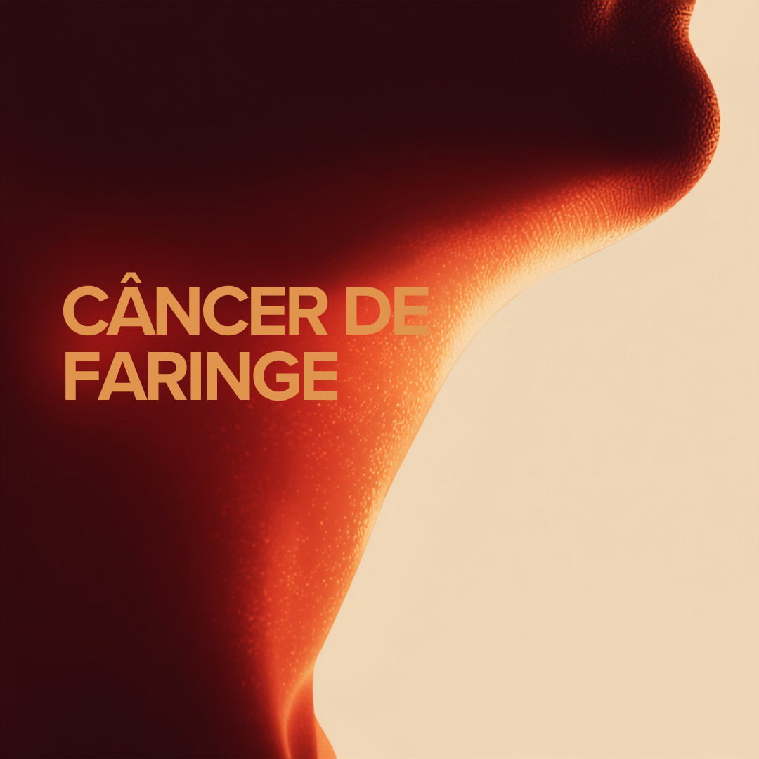 câncer de faringe sintomas HPV diagnóstico tratamento