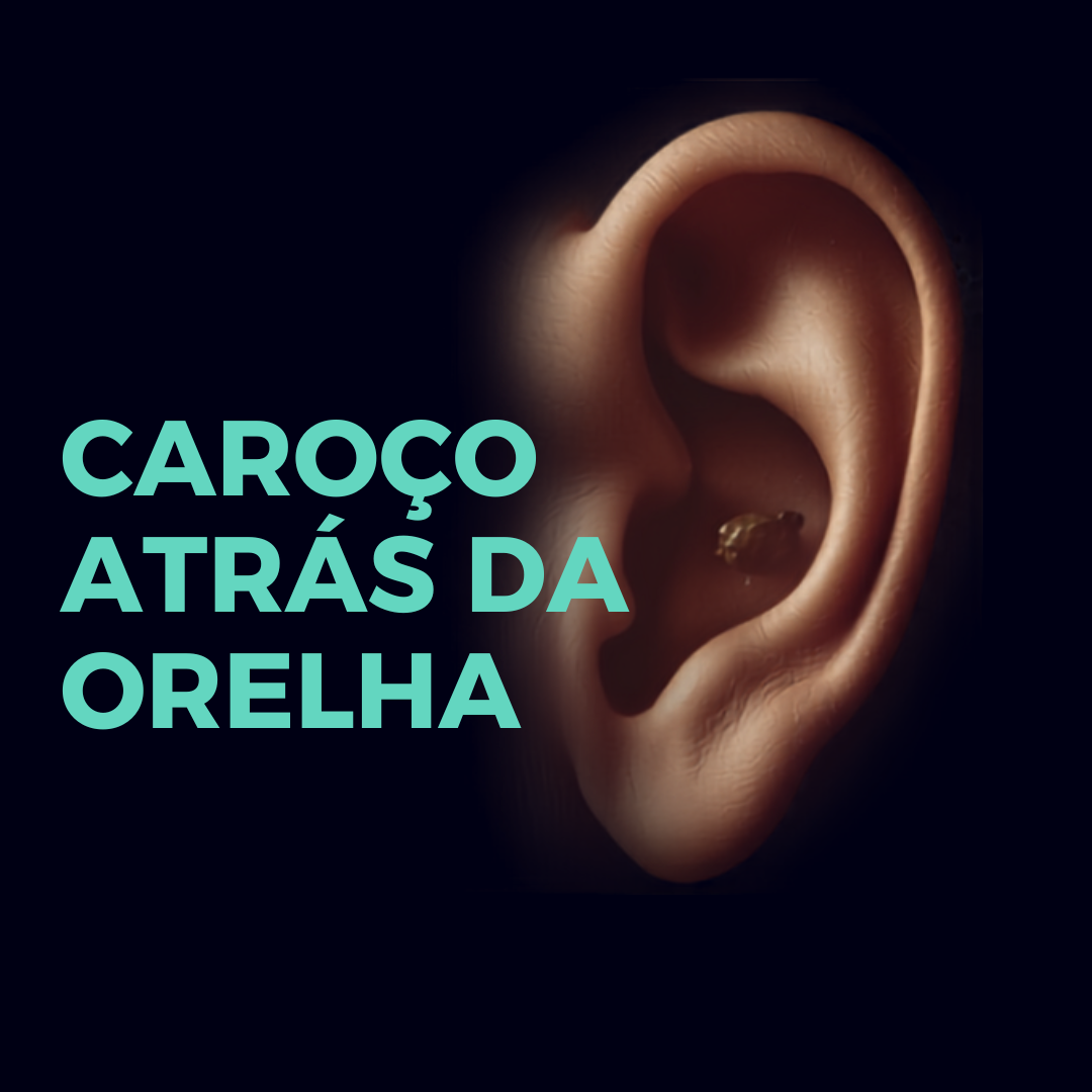 caroço atrás da orelha