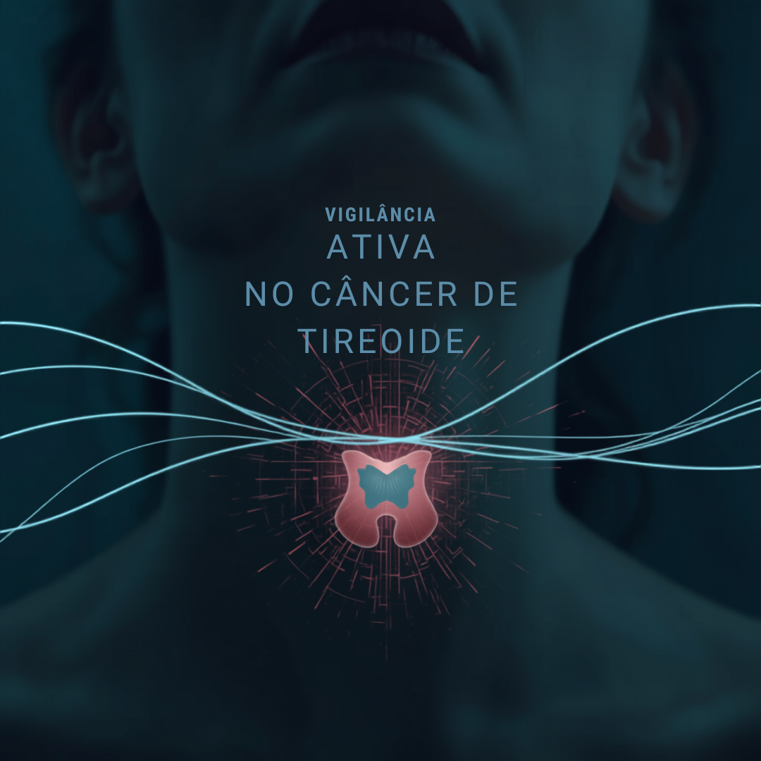 vigilância ativa no câncer de tireoide