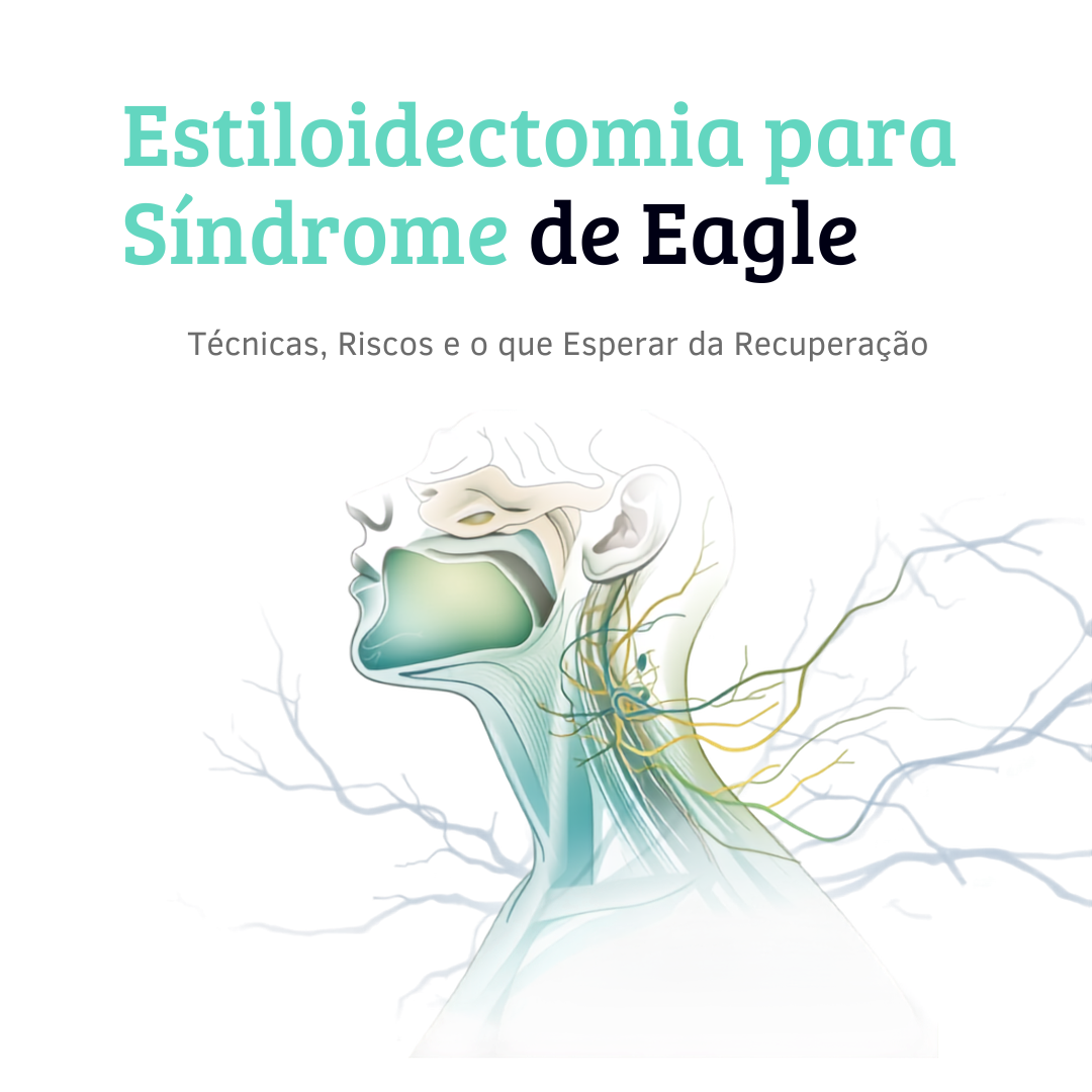 estiloidectomia para síndrome de Eagle